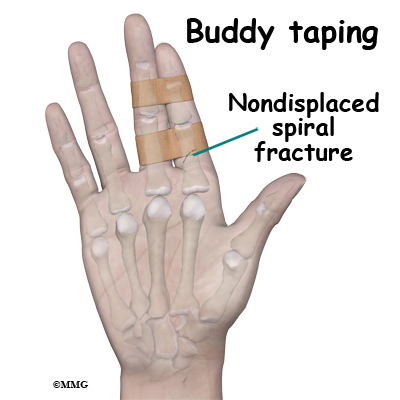 Buddy Tape Fingers