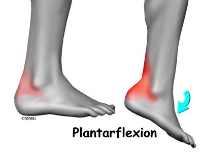 http://www.eorthopod.com/images/ContentImages/ankle/ankle_impingement/ankle_impingement_symptoms02.jpg