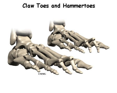 claw toe images