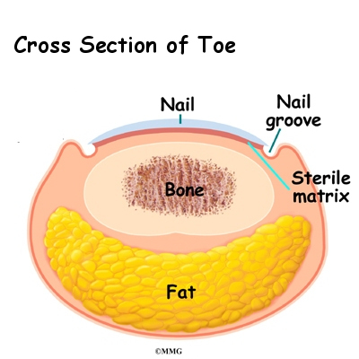 An ingrown toenail occurs when a corner of the toenail grows and digs into the skin at either the end of the toe or the side of the toe. Pain and inflammation in the affected area are the early symptoms of ingrown toenail. An ingrown toenail calls fo