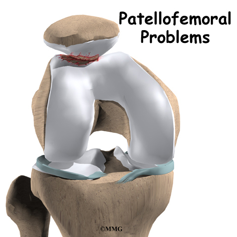 The patella, or kneecap,