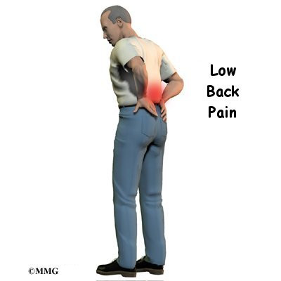 http://www.eorthopod.com/images/ContentImages/spine/spine_lumbar/low_back_pain/low_back_pain_intro01.jpg