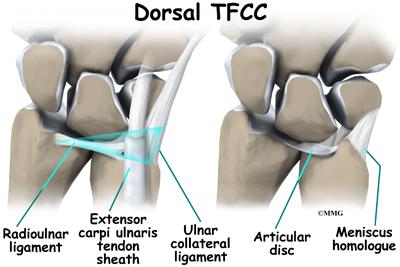 Triangular Fibrocartilage Complex (TFCC) Injuries - Orthopedic Surgery