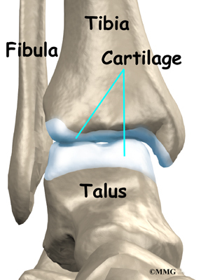 Ankle Arthritis | eOrthopod.com