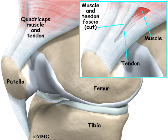 general_tendonitis_knee_anatomy05.jpg