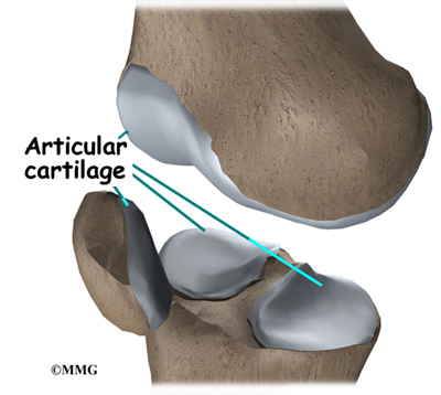 Weight Loss Seems to Spare Knee Cartilage