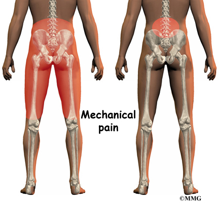 back pain kidney