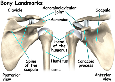Steroid arthropathy shoulder