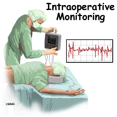 case study intraoperative monitoring