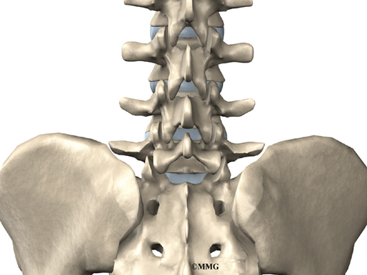 A Patient's Guide to Herniated Discs
