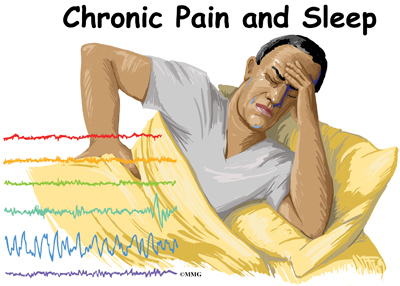 Image result for sleep and pain